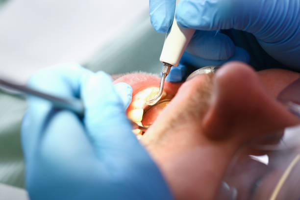 Best Chipped Tooth Repair Near Me  in Mesa, AZ